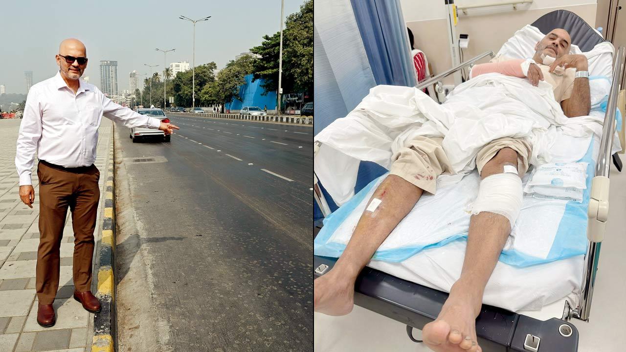 Four months after injuring legs in crash, runner gears for Mumbai Marathon